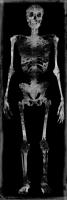 Skeleton III #WG112370
